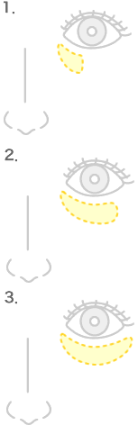 図：くまのパターン