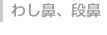 わし鼻、段鼻